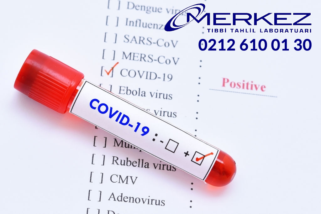 COVID-19 PCR Testi, COVID-19 PCR Testi Laboratuvar, Esenler COVID-19 PCR Testi, Esenler Pcr Testi, Esenler Korona Testi, Esenler Antikor testi, Esenler Covid-19 Testleri Laboratuvar